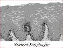 Normal Esophagus