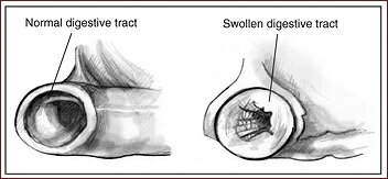 Normal Digestive Tract - Swollen Digestive Tract